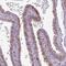 Alanine aminotransferase 2 antibody, PA5-62426, Invitrogen Antibodies, Immunohistochemistry paraffin image 