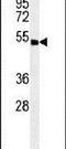 Abhydrolase Domain Containing 8 antibody, PA5-24492, Invitrogen Antibodies, Western Blot image 