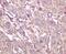 Caspase 5 antibody, M05259, Boster Biological Technology, Immunohistochemistry paraffin image 