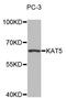 Lysine Acetyltransferase 5 antibody, MBS128135, MyBioSource, Western Blot image 