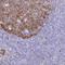 Ribonucleotide Reductase Catalytic Subunit M1 antibody, NBP2-49252, Novus Biologicals, Immunohistochemistry frozen image 