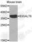 Beta-1,3-Galactosyltransferase 6 antibody, A3700, ABclonal Technology, Western Blot image 