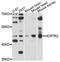 Hypocretin Receptor 2 antibody, MBS126369, MyBioSource, Western Blot image 