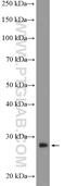 CTD Nuclear Envelope Phosphatase 1 antibody, 22088-1-AP, Proteintech Group, Western Blot image 