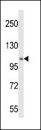Phosphatidylinositol 4-Kinase Beta antibody, LS-C163730, Lifespan Biosciences, Western Blot image 
