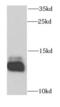 DnaJ Heat Shock Protein Family (Hsp40) Member C19 antibody, FNab02462, FineTest, Western Blot image 