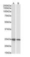 Growth Factor Receptor Bound Protein 2 antibody, orb18345, Biorbyt, Western Blot image 