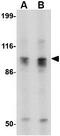 SLIT And NTRK Like Family Member 6 antibody, GTX85412, GeneTex, Western Blot image 