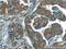 RAS Related 2 antibody, 12530-1-AP, Proteintech Group, Immunohistochemistry paraffin image 