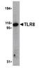 Toll Like Receptor 8 antibody, GTX77620, GeneTex, Western Blot image 