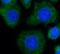 Radixin antibody, FNab07085, FineTest, Immunofluorescence image 