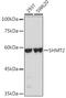 Serine Hydroxymethyltransferase 2 antibody, GTX64542, GeneTex, Western Blot image 