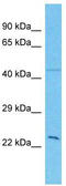 General Transcription Factor IIH Subunit 3 antibody, TA329286, Origene, Western Blot image 