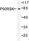 Ribosomal Protein S6 Kinase A1 antibody, LS-C176324, Lifespan Biosciences, Western Blot image 