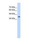 ST6 N-Acetylgalactosaminide Alpha-2,6-Sialyltransferase 5 antibody, NBP1-69618, Novus Biologicals, Western Blot image 