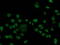 Fibroblast Growth Factor Receptor 2 antibody, LS-C786016, Lifespan Biosciences, Immunofluorescence image 