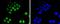Cyclin Dependent Kinase 9 antibody, NBP2-67811, Novus Biologicals, Immunofluorescence image 
