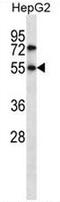 CHN antibody, AP52934PU-N, Origene, Western Blot image 