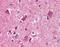 Pro-Apoptotic WT1 Regulator antibody, 51-362, ProSci, Immunohistochemistry paraffin image 