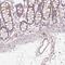 Ankyrin Repeat Domain 13B antibody, HPA063748, Atlas Antibodies, Immunohistochemistry paraffin image 