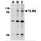 Toll Like Receptor 6 antibody, MBS150419, MyBioSource, Western Blot image 
