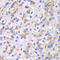 Cathepsin D antibody, 14-893, ProSci, Immunohistochemistry paraffin image 