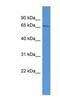 AB1IP antibody, NBP1-91631, Novus Biologicals, Western Blot image 