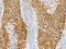 RAB27A, Member RAS Oncogene Family antibody, CSB-PA660209, Cusabio, Immunohistochemistry paraffin image 