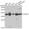 Casein Kinase 2 Alpha 1 antibody, abx001360, Abbexa, Western Blot image 