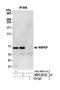 Arginyl Aminopeptidase antibody, NBP2-59130, Novus Biologicals, Western Blot image 