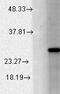 Potassium Calcium-Activated Channel Subfamily M Regulatory Beta Subunit 2 antibody, LS-C230897, Lifespan Biosciences, Western Blot image 