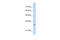 Myeloid Leukemia Factor 2 antibody, 30-209, ProSci, Western Blot image 