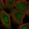 Cystatin A antibody, PA5-51502, Invitrogen Antibodies, Immunofluorescence image 