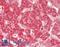 Ig kappa-b4 chain C region antibody, LS-B14297, Lifespan Biosciences, Immunohistochemistry paraffin image 