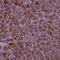 AP-5 complex subunit beta-1 antibody, PA5-64344, Invitrogen Antibodies, Immunohistochemistry paraffin image 