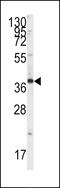 SH3 Domain Containing GRB2 Like, Endophilin B1 antibody, LS-C101109, Lifespan Biosciences, Western Blot image 