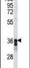 Transmembrane Protein 173 antibody, PA5-26808, Invitrogen Antibodies, Western Blot image 