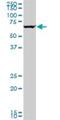 G Protein-Coupled Receptor Kinase 6 antibody, H00002870-M05, Novus Biologicals, Western Blot image 