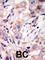 Receptor Tyrosine Kinase Like Orphan Receptor 2 antibody, abx033603, Abbexa, Western Blot image 