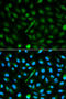 Alpha 2-HS Glycoprotein antibody, STJ22552, St John