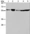 Nucleoporin 50 antibody, LS-C405213, Lifespan Biosciences, Western Blot image 