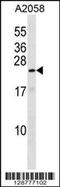 KRAB Box Domain Containing 4 antibody, 58-420, ProSci, Western Blot image 