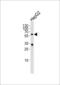 Interleukin 1 Receptor Type 1 antibody, LS-B9079, Lifespan Biosciences, Western Blot image 
