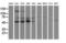 Protein Phosphatase, Mg2+/Mn2+ Dependent 1G antibody, M06725, Boster Biological Technology, Western Blot image 