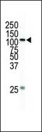 Mitogen-Activated Protein Kinase Kinase Kinase 1 antibody, PA5-15085, Invitrogen Antibodies, Western Blot image 