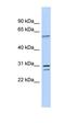 TRNA Selenocysteine 1 Associated Protein 1 antibody, orb324908, Biorbyt, Western Blot image 