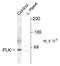 Polo Like Kinase 1 antibody, NB100-61108, Novus Biologicals, Western Blot image 