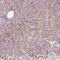 Zinc Finger Protein 460 antibody, HPA053004, Atlas Antibodies, Immunohistochemistry paraffin image 