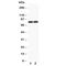 Transferrin Receptor 2 antibody, R31001, NSJ Bioreagents, Western Blot image 