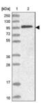 Catenin Alpha 1 antibody, NBP2-33456, Novus Biologicals, Western Blot image 
